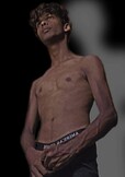 Babyanthony